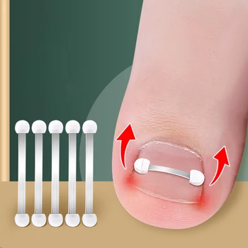 Инструменти за корекция на врастнали нокти на краката за педикюр за възстановяване на Врастнали нокти на краката Професионално средство за корекция на врастнали нокти на краката